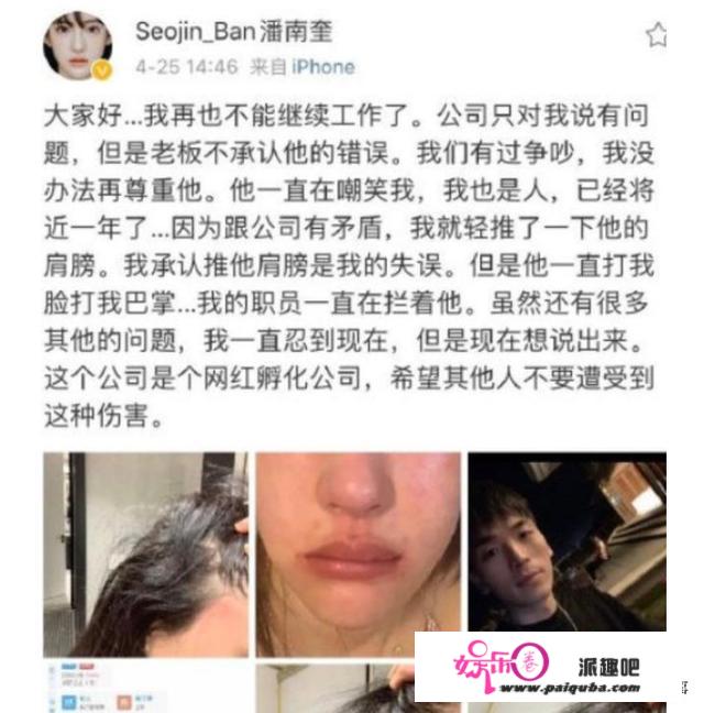 网红潘南奎遭暴打，脸部变形无法工作，疑似被公司解约，你有何看法？