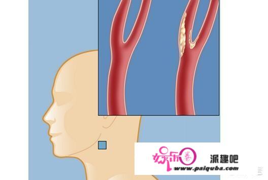 头晕是怎么回事？