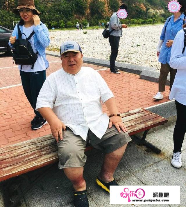 63岁董浩叔叔盛夏也穿长裤？罕见短裤现身，腿部状态终解其中缘由