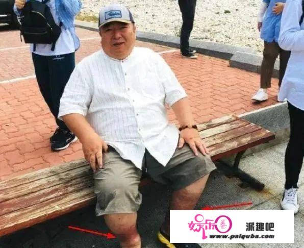 董浩叔叔与金龟子合体发福严重还站不起来，曾8天徘徊死亡边缘