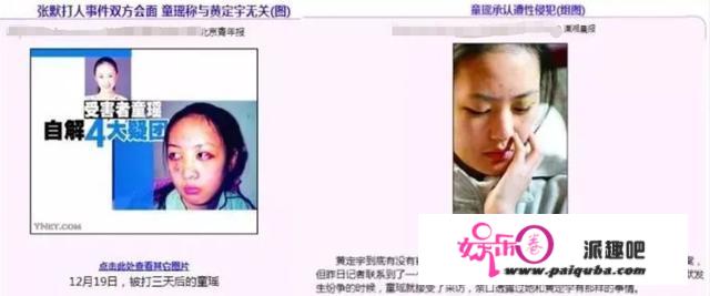 比顾佳还“美强惨”的是童瑶本人，刚翻红，就被爆出了被打丑闻