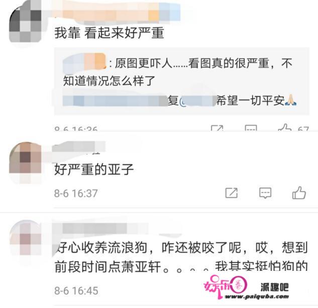 42岁曹格被狗咬伤，地上大片血迹惹人忧，网友却在嘲讽另一女星？