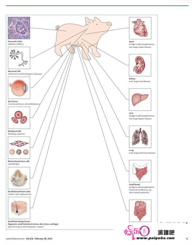 一头猪要若何拯救人类？异种移植从科学研究正走向临床治疗