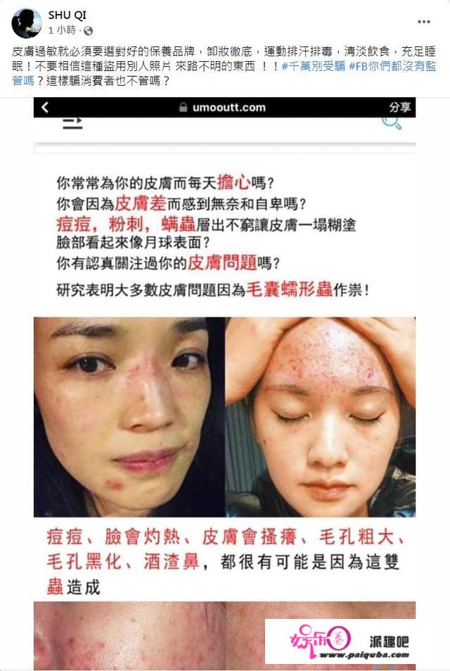 舒淇「满脸红斑」过敏照遭盗用！痛批脸书：消费者被骗也不管吗