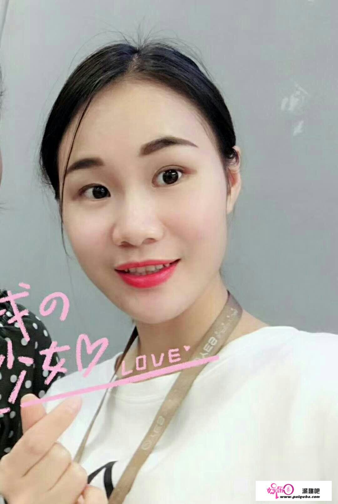 我是个美容美体师,听说做完腋臭手术就不能干体力活和重活，如果做完腋臭手术我还能还是从事我的工作吗